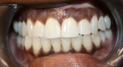 Cosmetic after