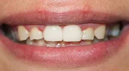 Cosmetic After 2