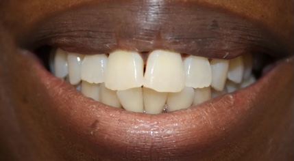 Cosmetic before