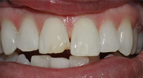 Before