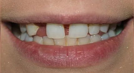 Before