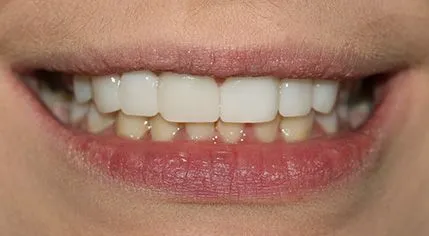 After