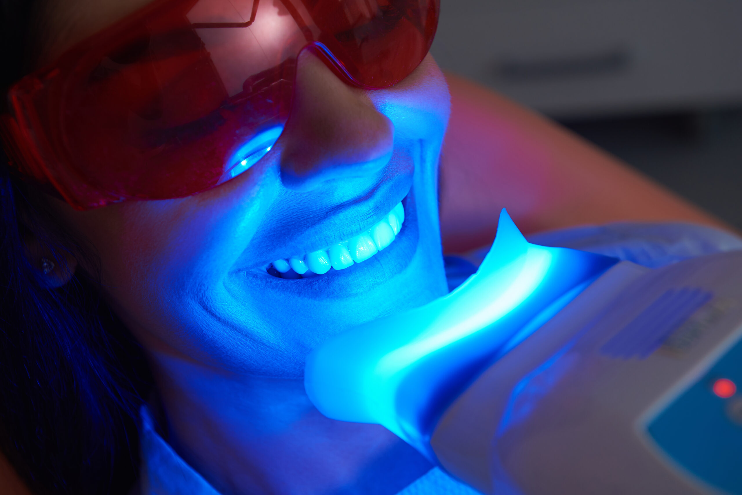 Professional vs. At-Home Teeth Whitening: Your Guide